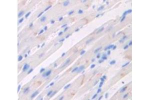 IHC-P analysis of Mouse Tissue, with DAB staining. (CACNA1C Antikörper  (AA 1978-2139))