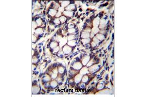 Immunohistochemistry (Paraffin-embedded Sections) (IHC (p)) image for anti-IQ Motif Containing with AAA Domain 1 (IQCA1) (AA 794-822), (C-Term) antibody (ABIN655947)