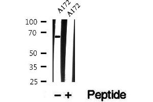 Western blot analysis of extracts of A172 cells, using Phospho-Atg14 (Ser29) Antibody.
