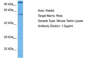 Host: Rabbit Target Name: RELA Sample Tissue: Mouse Testis Antibody Dilution: 1ug/ml (NF-kB p65 Antikörper  (Middle Region))