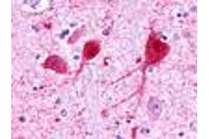 Anti-GALR3 antibody IHC of human brain, neurons and glia. (GALR3 Antikörper  (C-Term))