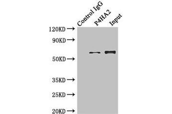 P4HA2 Antikörper  (AA 236-535)