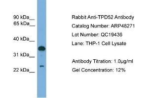 WB Suggested Anti-TPD52  Antibody Titration: 0. (TPD52 Antikörper  (C-Term))