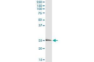 Western Blotting (WB) image for anti-Endothelin 3 (EDN3) (AA 1-238) antibody (ABIN560691)