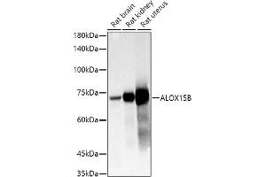 Western blot analysis of extracts of various cell lines, using B antibody (ABIN6129899, ABIN6136816, ABIN6136817 and ABIN6222589) at 1:1000 dilution. (ALOX15B Antikörper  (AA 1-200))