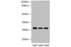 Western blot All lanes: C10orf82 antibody at 1 μg/mL Lane 1: A431 whole cell lysate Lane 2: HepG2 whole cell lysate Lane 3: Mouse thymus tissue Secondary Goat polyclonal to rabbit IgG at 1/10000 dilution Predicted band size: 27, 18, 13 kDa Observed band size: 27 kDa (RPAP2 Antikörper  (AA 1-154))