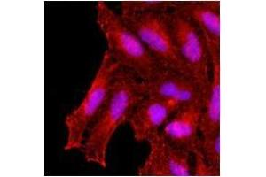Immunofluorescenitrocellulosee of human HeLa cells stained with monoclonal anti-human KCDT15 antibody (1:500) with Texas Red (Red). (KCTD15 Antikörper)