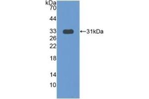 Detection of Recombinant COIL, Human using Polyclonal Antibody to Coilin (COIL) (Coilin Antikörper  (AA 319-538))
