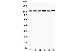 Western blot testing of Bub1 antibody and Lane 1:  rat testis;  2: (r) ovary;  3: (r) liver;  4: human Jurkat;  5: (h) COLO320;  6: (h) HEPG2. (BUB1 Antikörper  (AA 731-1085))