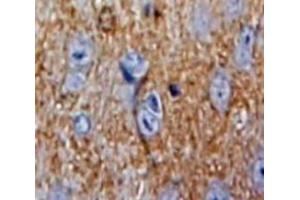 IHC-P analysis of Brain tissue, with DAB staining. (Superoxide dismutase copper chaperone Antikörper  (AA 17-270))