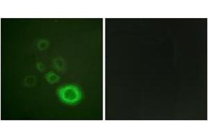 Immunofluorescence analysis of HepG2 cells, using c-Met (Phospho-Tyr1003) Antibody. (c-MET Antikörper  (pTyr1003))