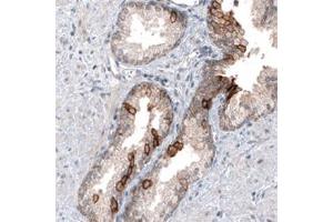Immunohistochemical staining of human prostate shows moderate cytoplasmic positivity in glandular cells. (MUC4 Antikörper)