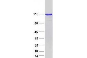TSR1 Protein (Myc-DYKDDDDK Tag)