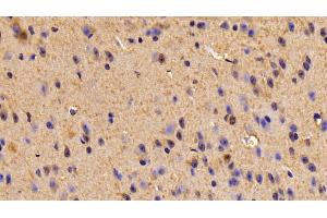 Detection of TUBb6 in Mouse Cerebrum Tissue using Polyclonal Antibody to Tubulin Beta 6 (TUBb6) (TUBb6 Antikörper  (AA 194-421))