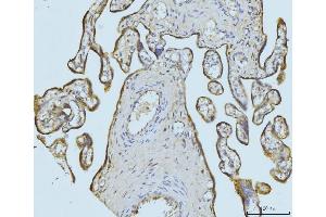 IHC analysis of ETFA using anti-ETFA antibody (ABIN7599281).