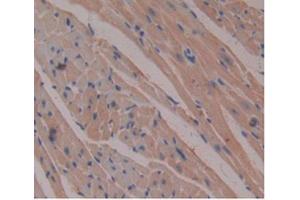 DAB staining on IHC-P Samples:Mouse Heart Tissue) (beta-2 Microglobulin Antikörper  (AA 22-119))