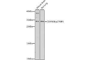 Western blot analysis of extracts of various cell lines, using CDKN1B/p27KIP1 antibody (ABIN7266603) at 1:3000 dilution. (CDKN1B Antikörper  (AA 1-100))
