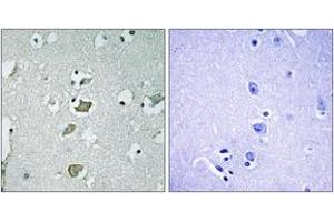 Immunohistochemistry analysis of paraffin-embedded human brain tissue, using KCNJ2 Antibody. (KCNJ2 Antikörper  (AA 81-130))