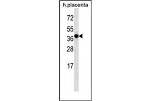 Western blot analysis of OR5H2 Antibody (OR5H2 Antikörper  (C-Term))