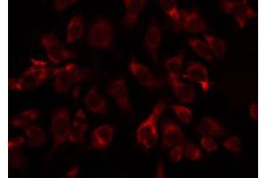 ABIN6274787 staining COLO205 by IF/ICC. (ABHD11 Antikörper  (C-Term))