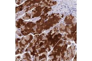 Immunohistochemical staining of human stomach with VKORC1 polyclonal antibody  shows strong cytoplasmic positivity in glandular cells. (VKORC1 Antikörper)
