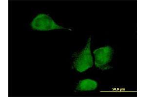 Immunofluorescence of purified MaxPab antibody to KLHDC4 on HeLa cell. (KLHDC4 Antikörper  (AA 1-520))