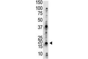 Western Blotting (WB) image for anti-Ubiquitin-Conjugating Enzyme E2G 2 (UBE2G2) antibody (ABIN3001458) (UBE2G2 Antikörper)