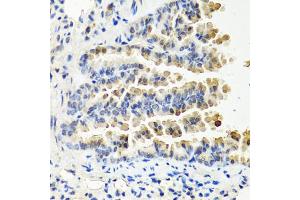 Immunohistochemistry of paraffin-embedded mouse lung using NTF3 antibody (ABIN6290616) at dilution of 1:100 (40x lens). (Neurotrophin 3 Antikörper)