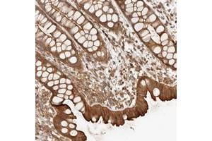 Immunohistochemical staining of human rectum with UFSP1 polyclonal antibody  shows strong cytoplasmic an membranous positivity in glandular cells. (UFSP1 Antikörper)