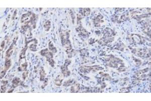 Immunohistochemistry (IHC) image for anti-Retinol Binding Protein 4, Plasma (RBP4) (AA 19-201) antibody (ABIN356231)