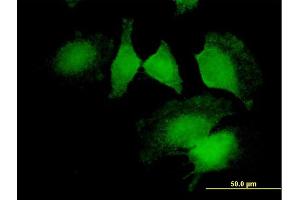 Immunofluorescence of purified MaxPab antibody to CNN2 on HeLa cell. (CNN2 Antikörper  (AA 1-270))