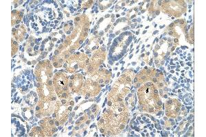 Immunohistochemistry (IHC) image for anti-Ketohexokinase (KHK) (C-Term) antibody (ABIN2776775) (Ketohexokinase Antikörper  (C-Term))