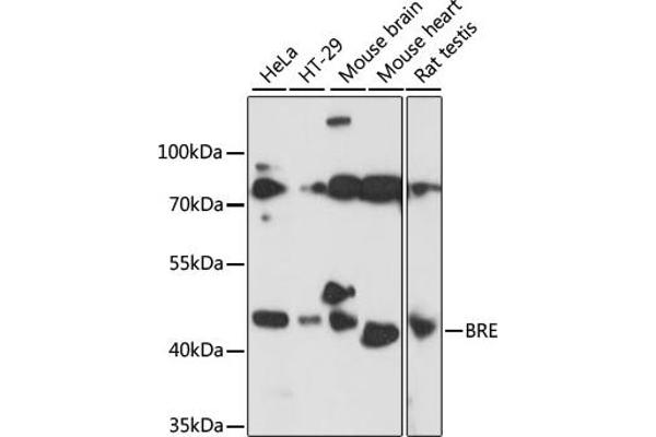 BRE Antikörper  (AA 51-229)