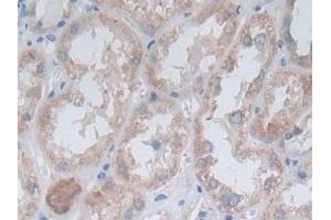 Detection of OAT in Human Kidney Tissue using Polyclonal Antibody to Ornithine Aminotransferase (OAT)