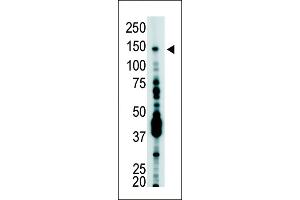 The anti-USP7 Pab (ABIN388889 and ABIN2839179) is used in Western blot to detect USP7 in T-47D cell lysate.