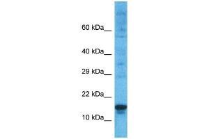 Host:  Rabbit  Target Name:  PRDM5  Sample Type:  ACHN Whole Cell lysates  Antibody Dilution:  1.