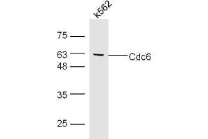 K562 cell lysates probed with Rabbit Anti-Cdc6 Polyclonal Antibody, Unconjugated  at 1:500 for 90 min at 37˚C. (CDC6 Antikörper)