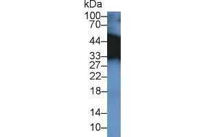 Western blot analysis of Mouse Placenta lysate, using Mouse TPM3 Antibody (2 µg/ml) and HRP-conjugated Goat Anti-Rabbit antibody ( (TPM3 Antikörper  (AA 6-248))