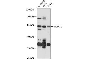 Western blot analysis of extracts of various cell lines, using TRIM11 antibody (ABIN6132732, ABIN6149500, ABIN6149501 and ABIN6218047) at 1:3000 dilution. (TRIM11 Antikörper  (AA 267-468))