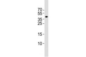 Western blot analysis of lysate from rat brain tissue lysate using Isl1 antibody at 1:1000. (ISL1 Antikörper  (C-Term))
