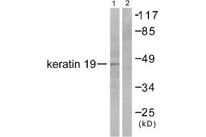 Western blot analysis of extracts from LOVO cells, using Keratin 19 antibody (ABIN5976439). (Cytokeratin 19 Antikörper  (Internal Region))