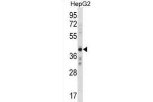 Western Blotting (WB) image for anti-AE Binding Protein 2 (AEBP2) antibody (ABIN3000396) (AEBP2 Antikörper)