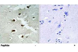 Immunohistochemistry analysis of paraffin-embedded human brain tissue using CDCA4 polyclonal antibody . (CDCA4 Antikörper)