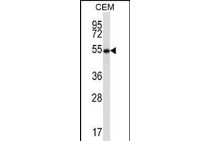 GAB Antibody (Center) (ABIN657961 and ABIN2846907) western blot analysis in CEM cell line lysates (35 μg/lane). (GABPA Antikörper  (AA 283-311))
