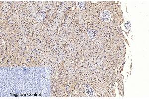 Immunohistochemical analysis of paraffin-embedded rat kidney tissue. (Caspase 3 p17 (AA 100-180), (Cleaved-Asp175) Antikörper)