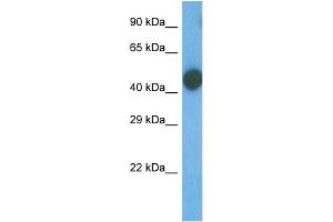 Host:  Rabbit  Target Name:  TRI58  Sample Type:  MCF7 Whole Cell  Antibody Dilution:  1. (TRIM58 Antikörper  (N-Term))