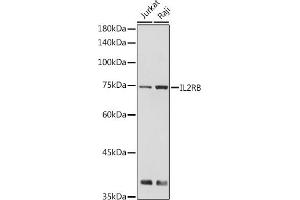 Western blot analysis of extracts of various cell lines, using IL2RB antibody (ABIN6127567, ABIN6142376, ABIN6142377 and ABIN6221796) at 1:500 dilution. (IL2 Receptor beta Antikörper  (AA 27-240))