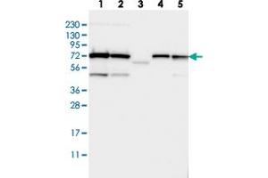 Western blot analysis of Lane 1: RT-4, Lane 2: U-251 MG, Lane 3: Human Plasma, Lane 4: Liver, Lane 5: Tonsil with TRIOBP polyclonal antibody  at 1:250-1:500 dilution. (TRIOBP Antikörper)