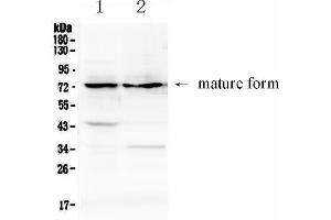 Western blot analysis of ADAM10 using anti-ADAM10 antibody . (ADAM10 Antikörper  (AA 214-325))