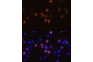 Immunofluorescence analysis of L929 cells using SW antibody (ABIN7270654) at dilution of 1:100. (SWAP70 Antikörper  (AA 316-585))